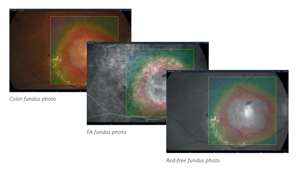 Multi-modal retinal imaging