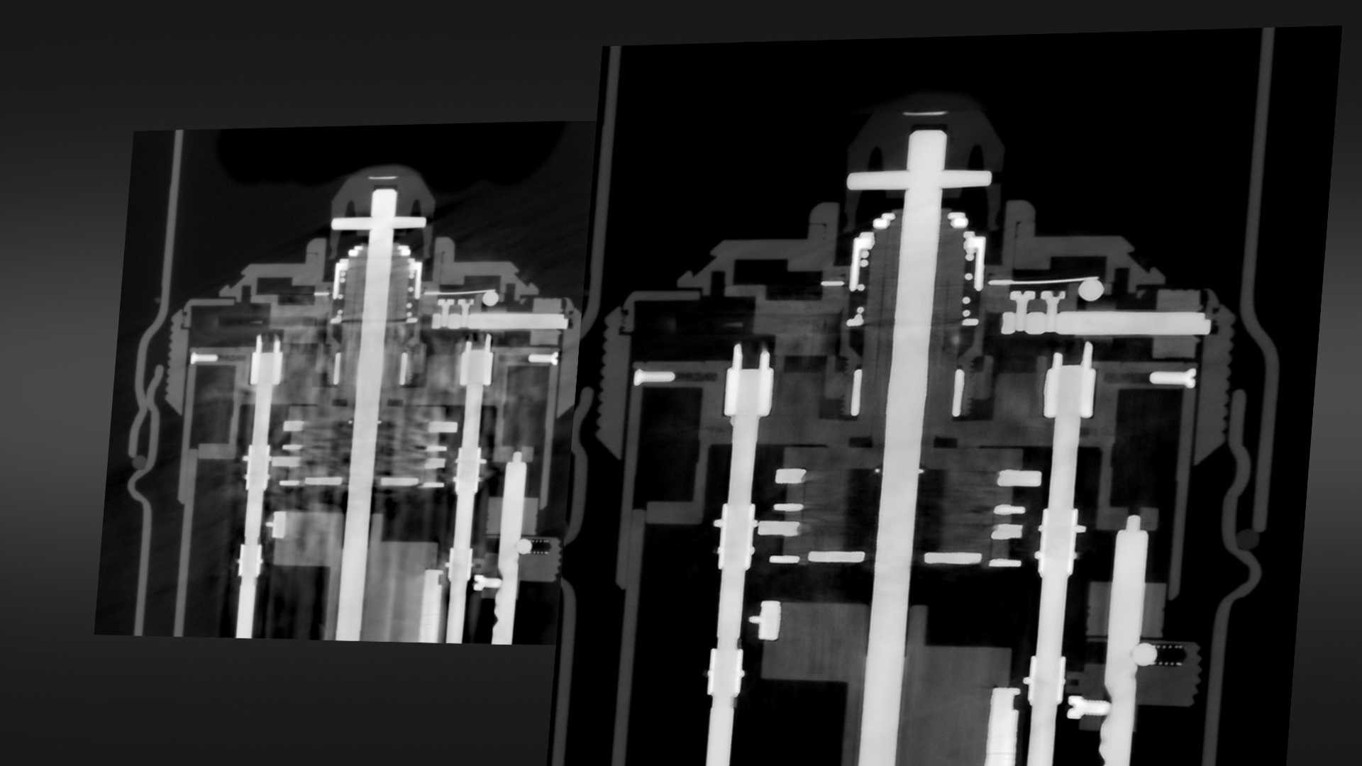 Reducción avanzada de artefactos de materiales mixtos (AMMAR)