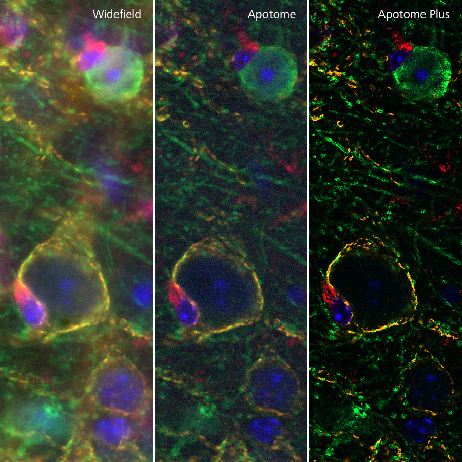  Sample courtesy of Uniiversity of California, Davis / NIH NeuroMab Facility