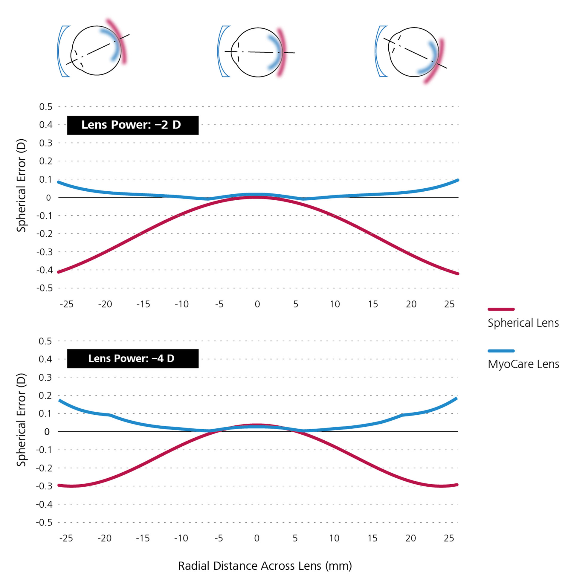 Dos gráficos lineales que muestran la simulación matemática comparativa de las lentes esféricas de visión sencilla (en rojo) y las lentes MyoCare (en azul).
