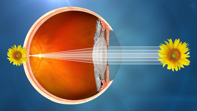 Visualización ilustrativa de un ojo sano.
