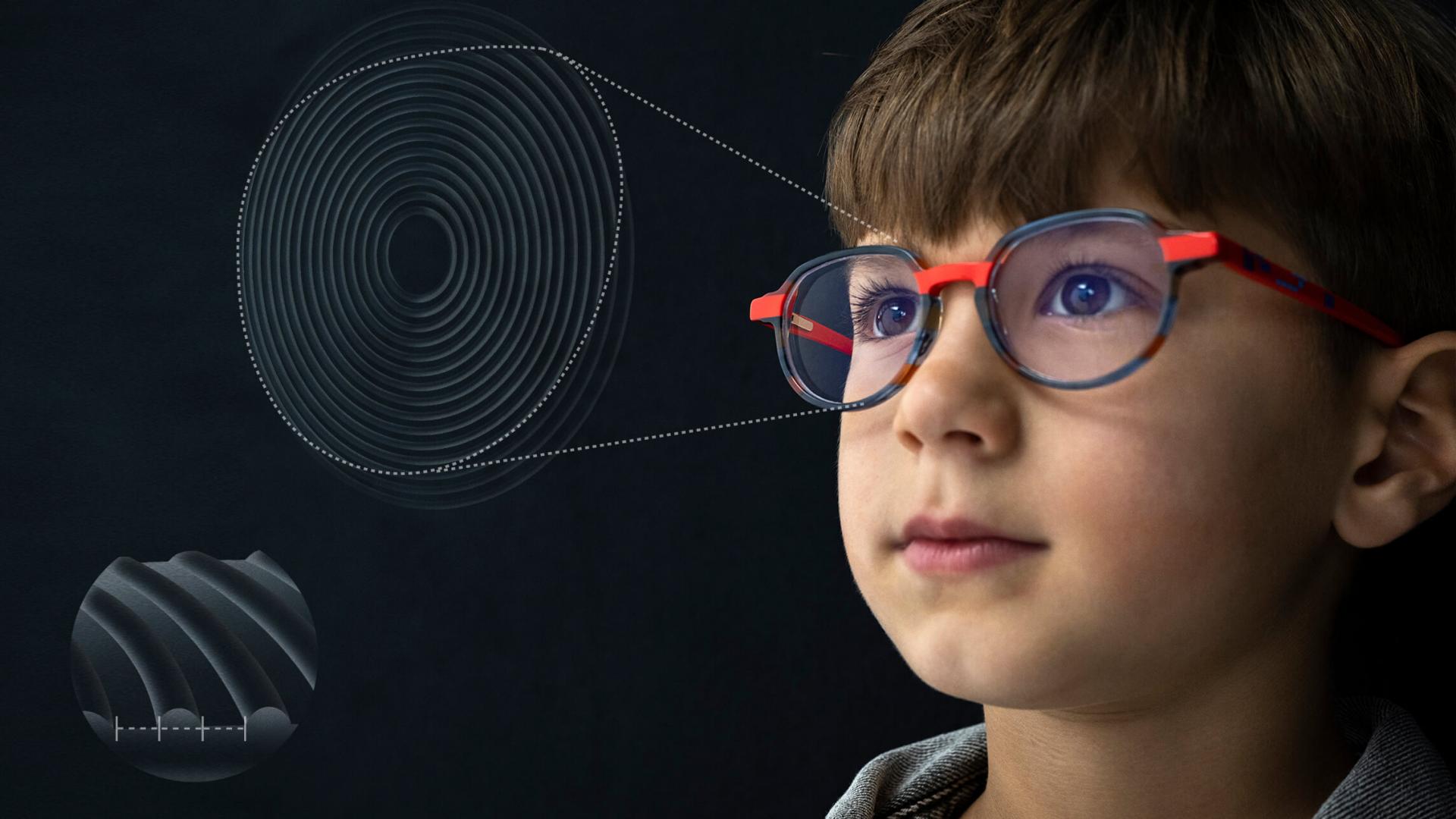 Una ilustración en primer plano del diseño de las lentes ZEISS MyoCare para el tratamiento de la miopía en niños.