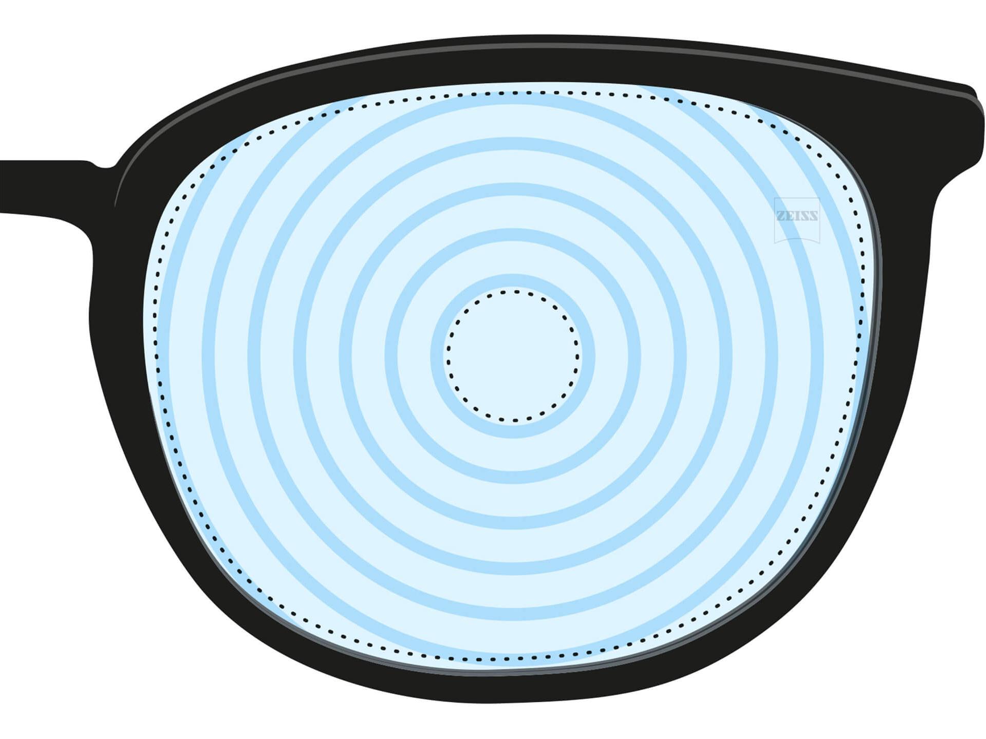 Una ilustración de una lente para el control de la miopía. Presenta círculos concéntricos que representan distintas potencias de lente. Se trata de un ejemplo de diseño de lente para un fin especializado.
