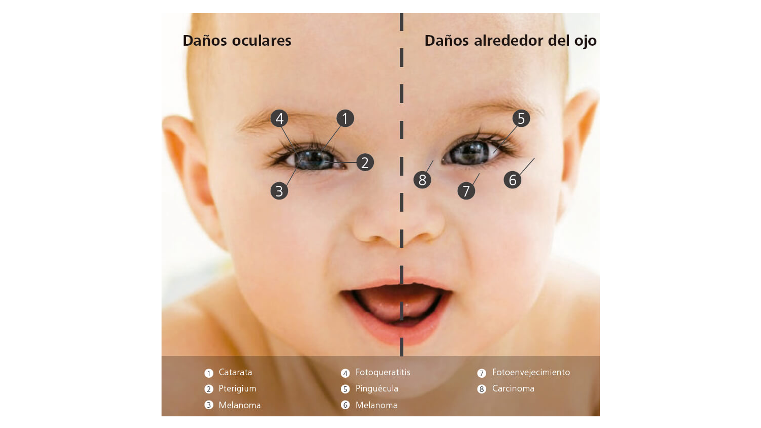 Este niño estará expuesto a muchos riesgos relacionados con los rayos UV a lo largo de su vida.