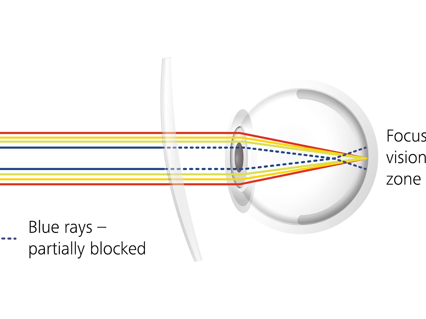 Visualización de cómo los recubrimientos para lentes pueden reducir el deslumbramiento al bloquear parcialmente los rayos azules 